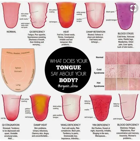 tongue color meaning traditional chinese medicine